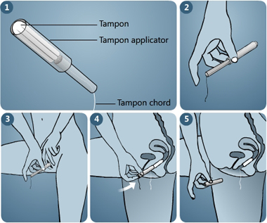 applicator-tampon