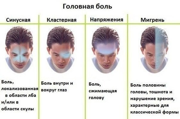 [28.04.2017 11:44] jcredit online ru:  у подростка болит голова 